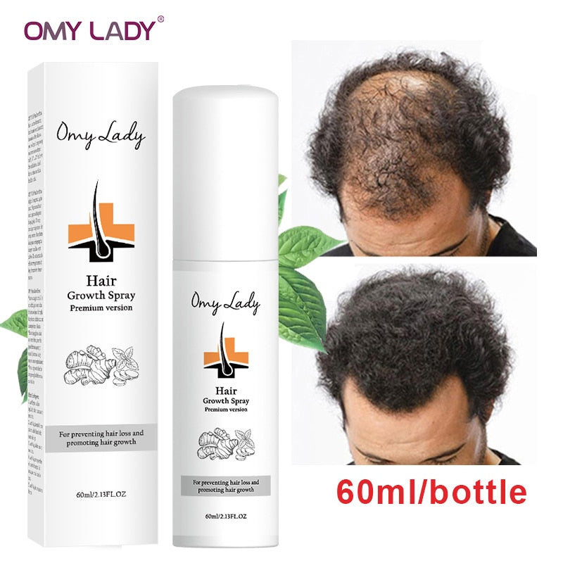 OMY LADY Hair Growth Spray Anti Hair Loss Essential Fast Regrowth Prevent Hair Damaged Thinning Repair Care Scalp Treatment 60ml